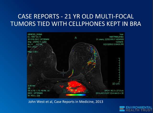 Ne pas confondre origine génétique et héréditaire du cancer