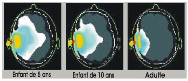 Haute certitude que les ondes cellulaires causent le cancer, selon une analyse des études animales commandée par l'OMS